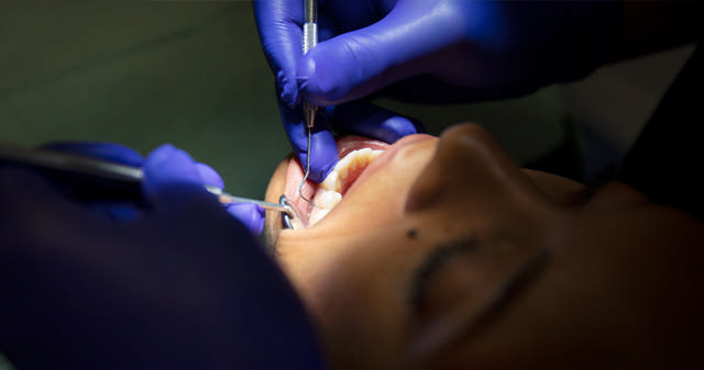 tandkødskorrektion