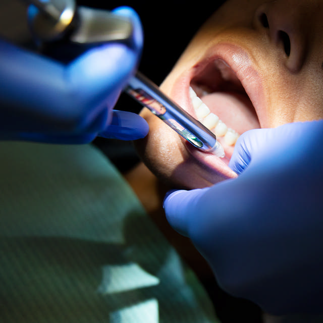 Lokalbedøvelse tandlæge