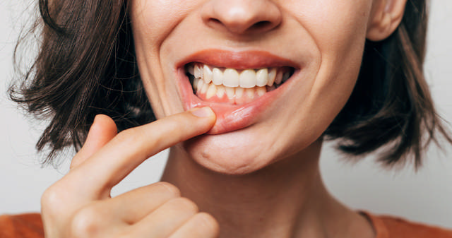 Symptomer på tandkødsbetændelse
