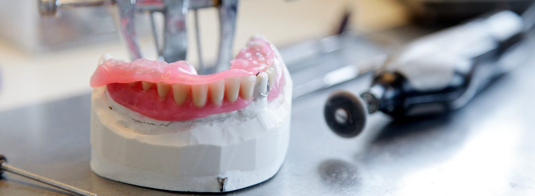 kolbøtte gennemførlig tobak Tandproteser til et smukt og naturligt smil. Læs mere | tandlægen.dk